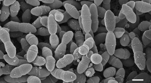 Streptokokken - Parasiten unter dem Mikroskop (Foto: Robert Koch Institut)